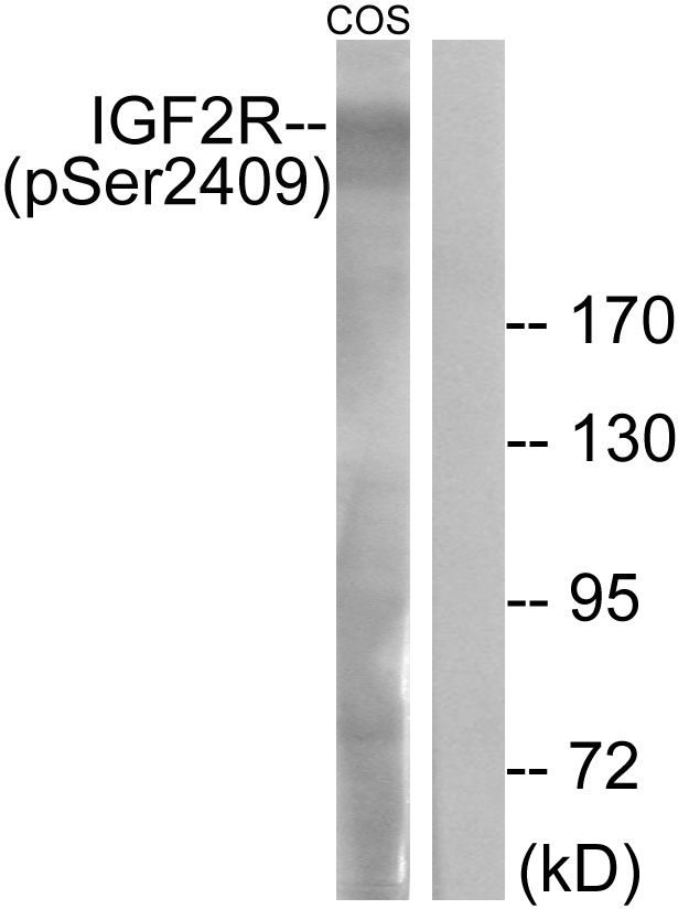 IGF2R / CD222 Antibody - Western blot analysis of lysates from COS7 cells treated with UV 15', using IGF2R (Phospho-Ser2409) Antibody. The lane on the right is blocked with the phospho peptide.
