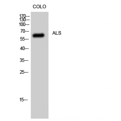 IGFALS / ALS Antibody - Western blot of ALS antibody