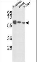 IGFALS / ALS Antibody - Western blot of IGFALS Antibody in mouse spleen tissue, Jurkat cell line and mouse liver tissue lysates (35 ug/lane). IGFALS (arrow) was detected using the purified antibody.
