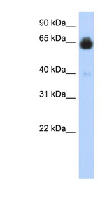IGFALS / ALS Antibody - IGFALS antibody Western blot of Transfected 293T cell lysate. This image was taken for the unconjugated form of this product. Other forms have not been tested.