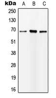 IGFALS / ALS Antibody - Western blot analysis of ALS expression in HEK293T (A); mouse liver (B); rat kidney (C) whole cell lysates.