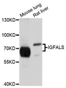IGFALS / ALS Antibody - Western blot analysis of extracts of various cell lines, using IGFALS antibody at 1:1000 dilution. The secondary antibody used was an HRP Goat Anti-Rabbit IgG (H+L) at 1:10000 dilution. Lysates were loaded 25ug per lane and 3% nonfat dry milk in TBST was used for blocking. An ECL Kit was used for detection and the exposure time was 1s.