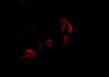 IGFALS / ALS Antibody - Staining COLO205 cells by IF/ICC. The samples were fixed with PFA and permeabilized in 0.1% Triton X-100, then blocked in 10% serum for 45 min at 25°C. The primary antibody was diluted at 1:200 and incubated with the sample for 1 hour at 37°C. An Alexa Fluor 594 conjugated goat anti-rabbit IgG (H+L) Ab, diluted at 1/600, was used as the secondary antibody.
