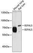 IGFALS / ALS Antibody - Western blot analysis of extracts of various cell lines using IGFALS Polyclonal Antibody at dilution of 1:1000.