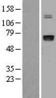 IGFALS / ALS Protein - Western validation with an anti-DDK antibody * L: Control HEK293 lysate R: Over-expression lysate