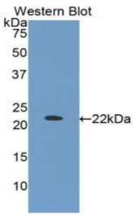IGFBP1 Antibody - Western blot of recombinant IGFBP1 / IGFBP-1.  This image was taken for the unconjugated form of this product. Other forms have not been tested.