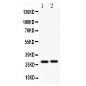 IGFBP1 Antibody - IGFBP1 antibody Western blot. All lanes: Anti IGFBP1 at 0.5 ug/ml. Lane 1: Rat Kidney Tissue Lysate at 50 ug. Lane 2: Mouse Kidney Tissue Lysate at 50 ug. Predicted band size: 28 kD. Observed band size: 28 kD.