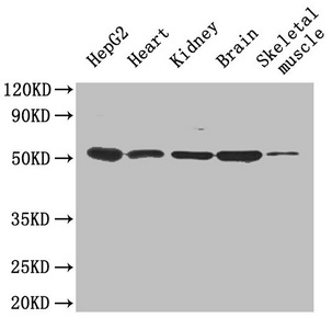 IGFBP1 Antibody - Western Blot Positive WB detected in: HepG2 cell, Mouse heart, Mouse kidney, Mouse brain, Mouse skeletal muscle All lanes: Igfbp1 antibody at 0.6µg/ml Secondary Goat polyclonal to rabbit IgG at 1/50000 dilution Predicted band size: 29 kDa Observed band size: 50 kDa