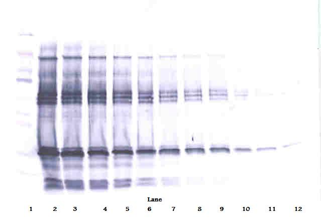 IGFBP1 Antibody - Biotinylated Anti-Human IGF-BP1 Western Blot Reduced