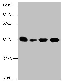 IGFBP1 Antibody - All lanes: Mouse anti- Human Insulin-like growth factor-binding protein 1 monoclonal antibody at 1ug/ml Lane 1:Pyrolysis liquid human placental tissue 7.5ug/ml Lane 2:Pyrolysis liquid human placental tissue 3.25ug/ml Lane 3:IGFBP1 transfected SF9 cell lysateLane 4: human amniotic fluid Secondary Goat polyclonal to Mouse IgG at 1/5000 dilution Predicted band size : 28kd Observed band size : 35kd