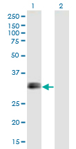 IGFBP1 Antibody - Western Blot analysis of IGFBP1 expression in transfected 293T cell line by IGFBP1 monoclonal antibody (M01), clone 2F9.Lane 1: IGFBP1 transfected lysate (Predicted MW: 27.9 KDa).Lane 2: Non-transfected lysate.