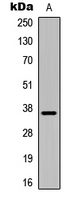 IGFBP1 Antibody - Western blot analysis of IGFBP1 expression in HepG2 (A) whole cell lysates.