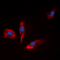 IGFBP1 Antibody - Immunofluorescent analysis of IGFBP1 staining in HepG2 cells. Formalin-fixed cells were permeabilized with 0.1% Triton X-100 in TBS for 5-10 minutes and blocked with 3% BSA-PBS for 30 minutes at room temperature. Cells were probed with the primary antibody in 3% BSA-PBS and incubated overnight at 4 ??C in a humidified chamber. Cells were washed with PBST and incubated with a DyLight 594-conjugated secondary antibody (red) in PBS at room temperature in the dark. DAPI was used to stain the cell nuclei (blue).