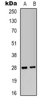 IGFBP1 Antibody - Western blot analysis of IGFBP1 expression in HepG2 (A); MCF7 (B) whole cell lysates.