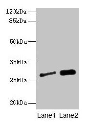 IGFBP1 Antibody - Western blot All lanes: IGFBP1 antibody at 3µg/ml Lane 1: HL60 whole cell lysate Lane 2: K562 whole cell lysate Lane 3: U87 whole cell lysate Lane 4: A549 whole cell lysate Lane 5: PC-3 whole cell lysate Secondary Goat polyclonal to rabbit IgG at 1/10000 dilution Predicted band size: 28 kDa Observed band size: 28 kDa