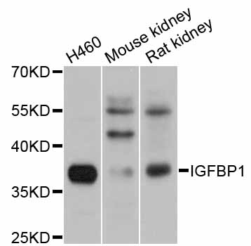IGFBP1 Antibody - Western blot analysis of extracts of various cell lines.