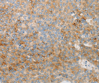 IGFBP1 Antibody - Immunohistochemistry of paraffin-embedded mouse spleen tissue tissue.