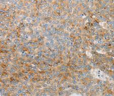 IGFBP1 Antibody - Immunohistochemistry of paraffin-embedded mouse spleen tissue tissue.