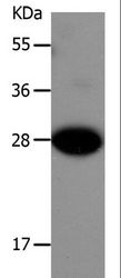 IGFBP1 Antibody - Western blot analysis of Mouse liver tissue, using IGFBP1 Polyclonal Antibody at dilution of 1:550.