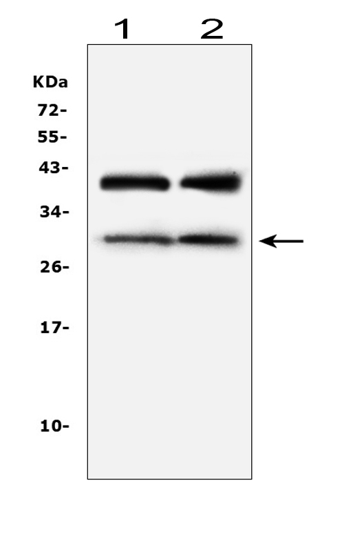 IGFBP1 Antibody - Western blot analysis of IGFBP1 using anti-IGFBP1 antibody. Electrophoresis was performed on a 5-20% SDS-PAGE gel at 70V (Stacking gel) / 90V (Resolving gel) for 2-3 hours. The sample well of each lane was loaded with 50ug of sample under reducing conditions. Lane 1: rat liver tissue lysates, Lane 2: mouse liver tissue lysates. After Electrophoresis, proteins were transferred to a Nitrocellulose membrane at 150mA for 50-90 minutes. Blocked the membrane with 5% Non-fat Milk/ TBS for 1.5 hour at RT. The membrane was incubated with rabbit anti-IGFBP1 antigen affinity purified polyclonal antibody at 0.5 µg/mL overnight at 4°C, then washed with TBS-0.1% Tween 3 times with 5 minutes each and probed with a goat anti-rabbit IgG-HRP secondary antibody at a dilution of 1:10000 for 1.5 hour at RT. The signal is developed using an Enhanced Chemiluminescent detection (ECL) kit with Tanon 5200 system. A specific band was detected for IGFBP1 at approximately 30KD. The expected band size for IGFBP1 is at 28KD.
