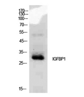 IGFBP1 Antibody - Western Blot analysis of extracts from MCF7 cells using IGFBP1 Antibody.