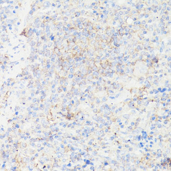 IGFBP1 Antibody - Immunohistochemistry of paraffin-embedded rat spleen using IGFBP1 antibody at dilution of 1:100 (40x lens).