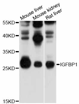 IGFBP1 Antibody - Western blot analysis of extracts of various cell lines, using IGFBP1 antibody at 1:1000 dilution. The secondary antibody used was an HRP Goat Anti-Rabbit IgG (H+L) at 1:10000 dilution. Lysates were loaded 25ug per lane and 3% nonfat dry milk in TBST was used for blocking. An ECL Kit was used for detection and the exposure time was 5s.