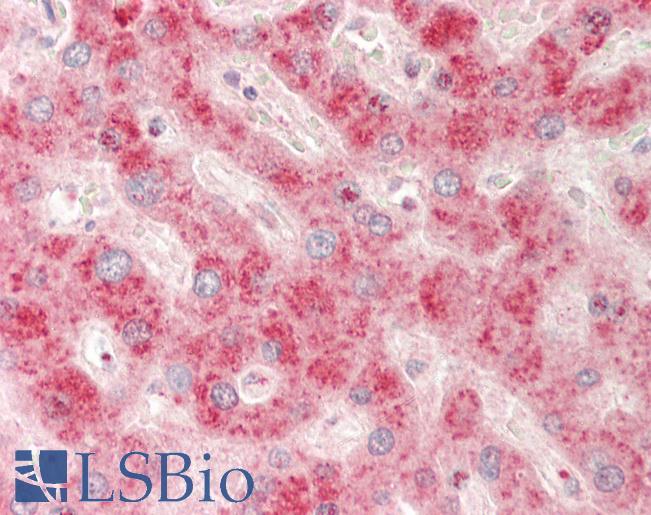 IGFBP2 / IGF-BP53 Antibody - Human Liver: Formalin-Fixed, Paraffin-Embedded (FFPE).  This image was taken for the unconjugated form of this product. Other forms have not been tested.