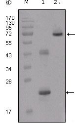 IGFBP2 / IGF-BP53 Antibody - IGFBP2 Antibody in Western Blot (WB)