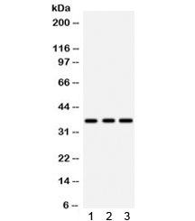 IGFBP2 / IGF-BP53 Antibody