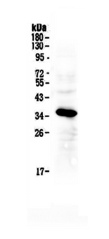 IGFBP2 / IGF-BP53 Antibody - Western blot - Anti-IGFBP2 Picoband Antibody