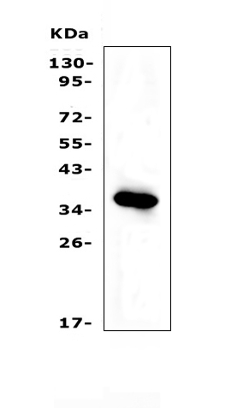 IGFBP2 / IGF-BP53 Antibody - Western blot analysis of IGFBP2 using anti-IGFBP2 antibody. Electrophoresis was performed on a 5-20% SDS-PAGE gel at 70V (Stacking gel) / 90V (Resolving gel) for 2-3 hours. The sample well of each lane was loaded with 50ug of sample under reducing conditions. Lane 1: human HepG2 whole cell lysates. After Electrophoresis, proteins were transferred to a Nitrocellulose membrane at 150mA for 50-90 minutes. Blocked the membrane with 5% Non-fat Milk/ TBS for 1.5 hour at RT. The membrane was incubated with rabbit anti-IGFBP2 antigen affinity purified polyclonal antibody at 0.5 ug/mL overnight at 4?, then washed with TBS-0.1% Tween 3 times with 5 minutes each and probed with a goat anti-rabbit IgG-HRP secondary antibody at a dilution of 1:10000 for 1.5 hour at RT. The signal is developed using an Enhanced Chemiluminescent detection (ECL) kit with Tanon 5200 system. A specific band was detected for IGFBP2 at approximately 35KD. The expected band size for IGFBP2 is at 35KD.