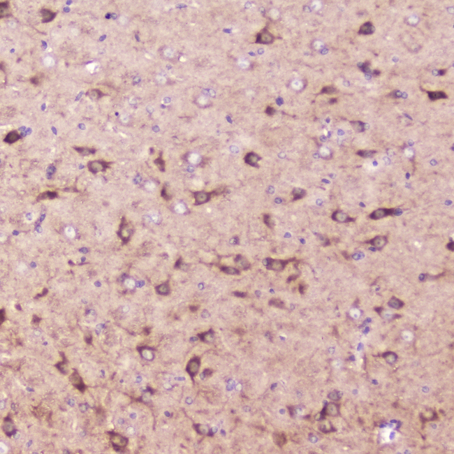 IGFBP2 / IGF-BP53 Antibody - IHC analysis of IGFBP2 using anti-IGFBP2 antibody. IGFBP2 was detected in paraffin-embedded section of mouse brain tissue . Heat mediated antigen retrieval was performed in citrate buffer (pH6, epitope retrieval solution) for 20 mins. The tissue section was blocked with 10% goat serum. The tissue section was then incubated with 2?g/ml rabbit anti-IGFBP2 Antibody overnight at 4?C. Biotinylated goat anti-rabbit IgG was used as secondary antibody and incubated for 30 minutes at 37?C. The tissue section was developed using Strepavidin-Biotin-Complex (SABC) with DAB as the chromogen.