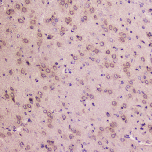 IGFBP2 / IGF-BP53 Antibody - IHC analysis of IGFBP2 using anti-IGFBP2 antibody. IGFBP2 was detected in paraffin-embedded section of rat brain tissue . Heat mediated antigen retrieval was performed in citrate buffer (pH6, epitope retrieval solution) for 20 mins. The tissue section was blocked with 10% goat serum. The tissue section was then incubated with 2µg/ml rabbit anti-IGFBP2 Antibody overnight at 4°C. Biotinylated goat anti-rabbit IgG was used as secondary antibody and incubated for 30 minutes at 37°C. The tissue section was developed using Strepavidin-Biotin-Complex (SABC) with DAB as the chromogen.