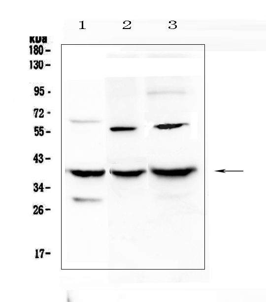 IGFBP2 / IGF-BP53 Antibody - Western blot analysis of IGFBP2 using anti-IGFBP2 antibody. Electrophoresis was performed on a 5-20% SDS-PAGE gel at 70V (Stacking gel) / 90V (Resolving gel) for 2-3 hours. The sample well of each lane was loaded with 50ug of sample under reducing conditions. Lane 1: rat liver tissue lysates, Lane 2: mouse Neuro-2a whole cell lysates,Lane 3: mouse HEPA1-6 whole cell lysates. After Electrophoresis, proteins were transferred to a Nitrocellulose membrane at 150mA for 50-90 minutes. Blocked the membrane with 5% Non-fat Milk/ TBS for 1.5 hour at RT. The membrane was incubated with rabbit anti-IGFBP2 antigen affinity purified polyclonal antibody at 0.5 ?g/mL overnight at 4?C, then washed with TBS-0.1% Tween 3 times with 5 minutes each and probed with a goat anti-rabbit IgG-HRP secondary antibody at a dilution of 1:10000 for 1.5 hour at RT. The signal is developed using an Enhanced Chemiluminescent detection (ECL) kit with Tanon 5200 system. A specific band was detected for IGFBP2 at approximately 40KD. The expected band size for IGFBP2 is at 35KD.