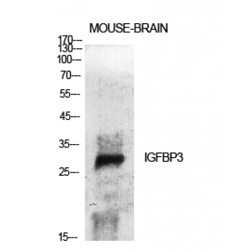 IGFBP3 Antibody - Western blot of IGFBP3 antibody