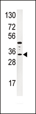 IGFBP3 Antibody - Western blot of anti-IGFBP3 Antibody in HepG2 cell line lysates (35 ug/lane). IGFBP3(arrow) was detected using the purified antibody.