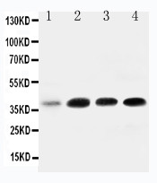 IGFBP3 Antibody - WB of IGFBP3 / IGFBP-3 antibody. All lanes: Anti-IGFBP3 at 0.5ug/ml. Lane 1: Rat Brain Tissue Lysate at 40ug. Lane 2: MCF-7 Whole Cell Lysate at 40ug. Lane 3: A549 Whole Cell Lysate at 40ug. Lane 4: SW620 Whole Cell Lysate at 40ug. Predicted bind size: 32KD. Observed bind size: 40KD.