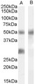 IGFBP3 Antibody - Antibody (0.02 ug/ml) staining of Human Breast cancer lysate (35 ug protein in RIPA buffer) with (B) and without (A) blocking with the immunizing peptide. Primary incubation was 1 hour. Detected by chemiluminescence.