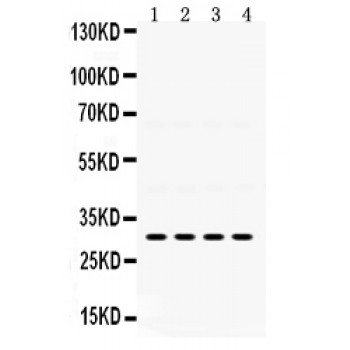 IGFBP3 Antibody - IGFBP3 antibody Western blot. All lanes: Anti IGFBP3 at 0.5 ug/ml. Lane 1: Rat Kidney Tissue Lysate at 50 ug. Lane 2: Rat Liver Tissue Lysate at 50 ug. Lane 3: SGC Whole Cell Lysate at 40 ug. Lane 4: 22RV1 Whole Cell Lysate at 40 ug. Predicted band size: 31 kD. Observed band size: 31 kD.