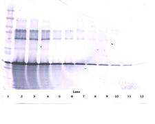 IGFBP3 Antibody - Biotinylated Anti-Human IGF-BP3 Western Blot Reduced