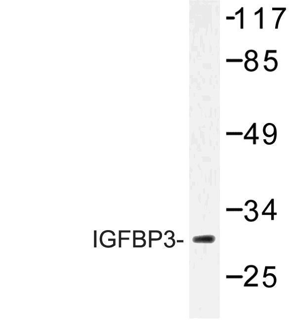 IGFBP3 Antibody - Western blot of IGFBP3 (H179) pAb in extracts from HUVEC cells.