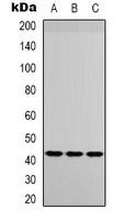 IGFBP3 Antibody - Western blot analysis of IGFBP3 expression in HUVEC (A); Raw264.7 (B); mouse brain (C) whole cell lysates.