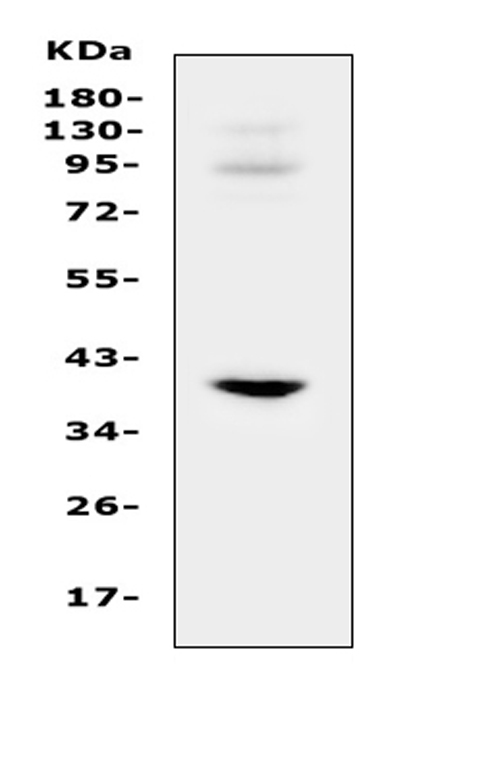 IGFBP3 Antibody - Western blot analysis of IGFBP3 using anti-IGFBP3 antibody. Electrophoresis was performed on a 5-20% SDS-PAGE gel at 70V (Stacking gel) / 90V (Resolving gel) for 2-3 hours. The sample well of each lane was loaded with 50ug of sample under reducing conditions. Lane 1: rat heart tissue lysates. After Electrophoresis, proteins were transferred to a Nitrocellulose membrane at 150mA for 50-90 minutes. Blocked the membrane with 5% Non-fat Milk/ TBS for 1.5 hour at RT. The membrane was incubated with rabbit anti-IGFBP3 antigen affinity purified polyclonal antibody at 0.5 ug/mL overnight at 4?, then washed with TBS-0.1% Tween 3 times with 5 minutes each and probed with a goat anti-rabbit IgG-HRP secondary antibody at a dilution of 1:10000 for 1.5 hour at RT. The signal is developed using an Enhanced Chemiluminescent detection (ECL) kit with Tanon 5200 system. A specific band was detected for IGFBP3 at approximately 40KD. The expected band size for IGFBP3 is at 32KD.