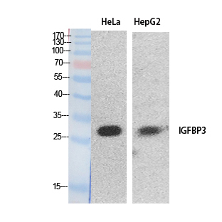 IGFBP3 Antibody - Western Blot analysis of extracts from HeLa, HepG2 cells using IGFBP3 Antibody.