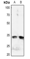 IGFBP3 Antibody - Western blot analysis of IGFBP3 (pS183) expression in Hela (A), HEK293T (B) whole cell lysates.