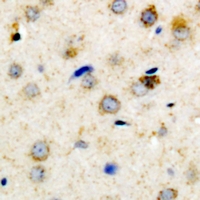 IGFBP3 Antibody - Immunohistochemical analysis of IGFBP3 (pS183) staining in human brain formalin fixed paraffin embedded tissue section. The section was pre-treated using heat mediated antigen retrieval with sodium citrate buffer (pH 6.0). The section was then incubated with the antibody at room temperature and detected using an HRP conjugated compact polymer system. DAB was used as the chromogen. The section was then counterstained with haematoxylin and mounted with DPX.