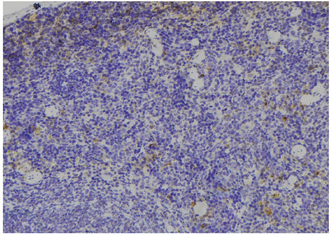 IGFBP3 Antibody - 1:100 staining human spleen tissue by IHC-P. The sample was formaldehyde fixed and a heat mediated antigen retrieval step in citrate buffer was performed. The sample was then blocked and incubated with the antibody for 1.5 hours at 22°C. An HRP conjugated goat anti-rabbit antibody was used as the secondary.