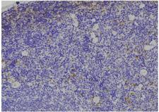 IGFBP3 Antibody - 1:100 staining human spleen tissue by IHC-P. The sample was formaldehyde fixed and a heat mediated antigen retrieval step in citrate buffer was performed. The sample was then blocked and incubated with the antibody for 1.5 hours at 22°C. An HRP conjugated goat anti-rabbit antibody was used as the secondary.