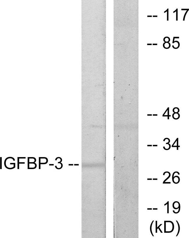 IGFBP3 Antibody - Western blot analysis of extracts from HUVEC cells, using IGFBP-3 (Ab-183) antibody.